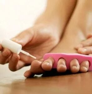 Anwendung des therapeutischen Lacks