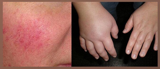 Nebenwirkungen von Tropfen